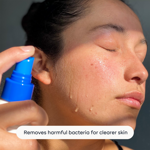 Magic Molecule Hypochlorous Acid Spray #4
